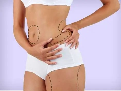Inch Loss and body contouring treatment 1