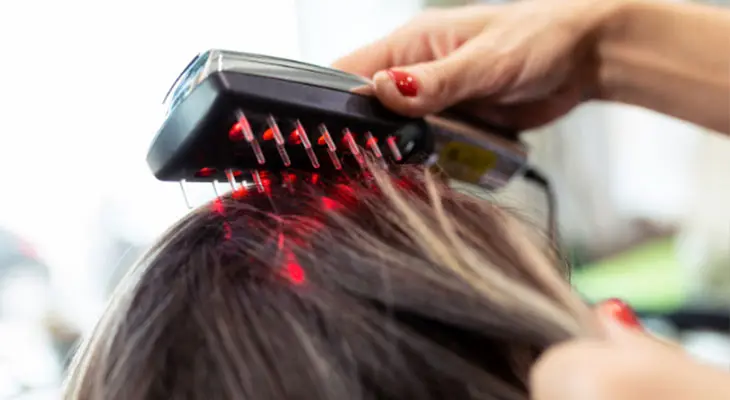 Laser Hair Loss Treatments in Norwich