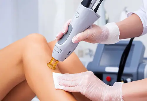 Laser Hair Removal in Norwich