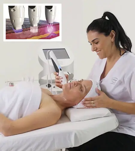 Laser Hair Removal for Face