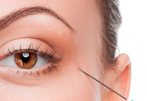 Eye Rejuvenation Treatment in Norwich View