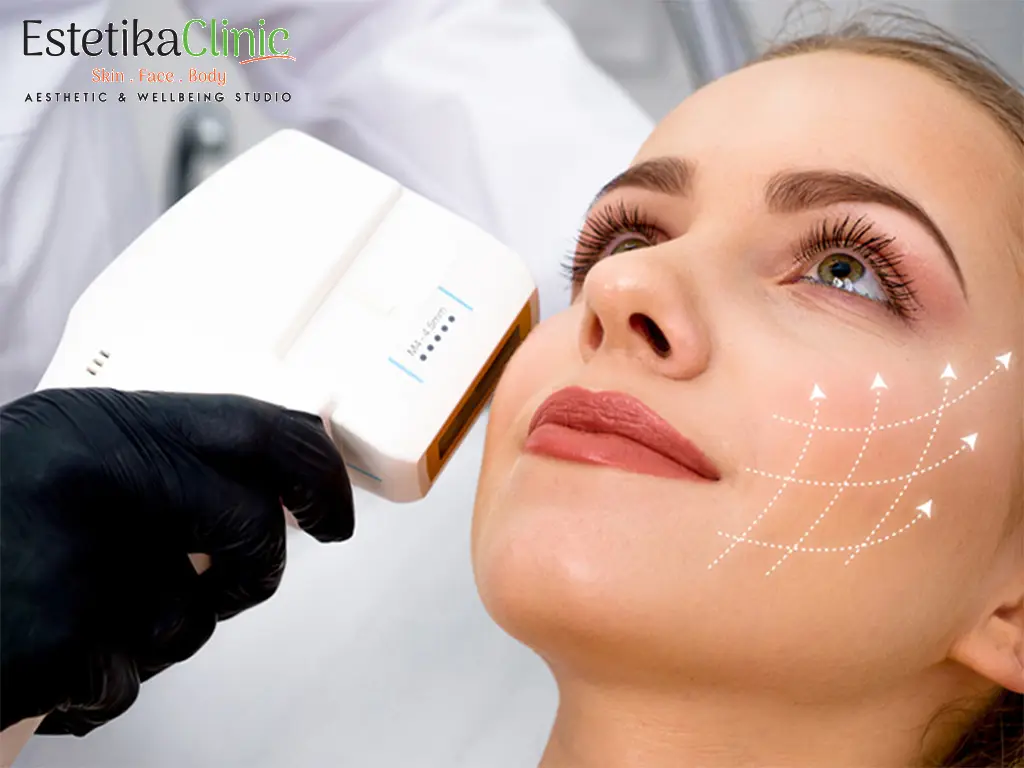 Microneedling Treatment in Norwich