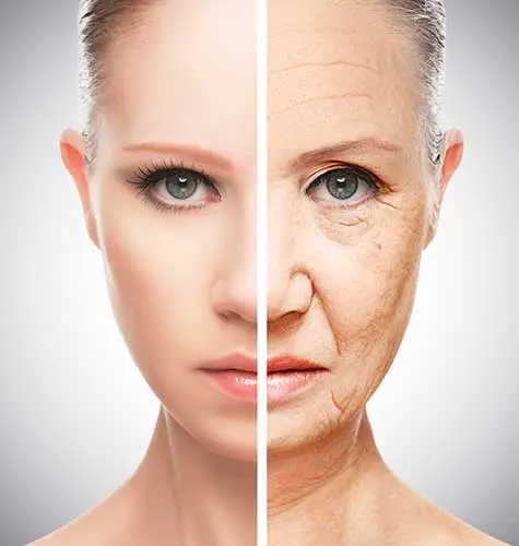 Skin Tightening Treatment Before and After View