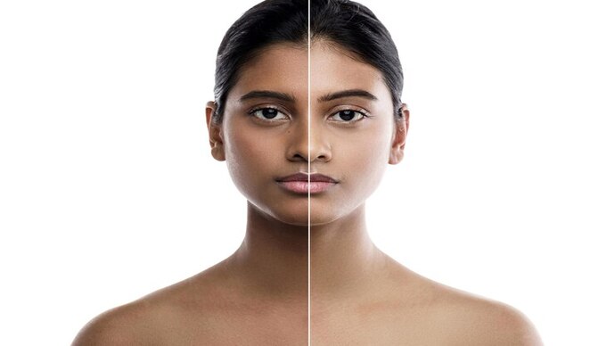 Carbon Facial