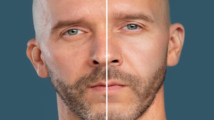 Carbon Facial 3