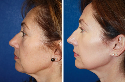 Skin Rejuv